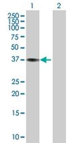 CTSK Antibody in Western Blot (WB)