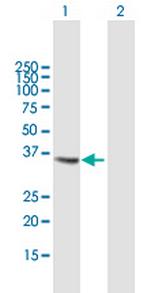 CTSS Antibody in Western Blot (WB)