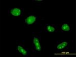 CYLD Antibody in Immunocytochemistry (ICC/IF)