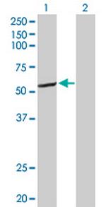 CYP2C8 Antibody in Western Blot (WB)