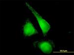 CYP2E1 Antibody in Immunocytochemistry (ICC/IF)