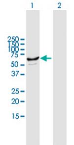 CYP2J2 Antibody in Western Blot (WB)