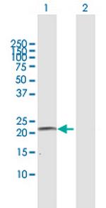 CYP4A11 Antibody in Western Blot (WB)