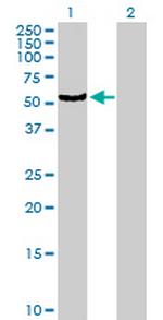 CYP4B1 Antibody in Western Blot (WB)