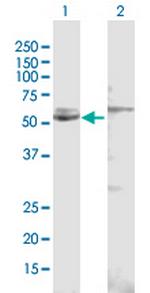 CYP51A1 Antibody in Western Blot (WB)