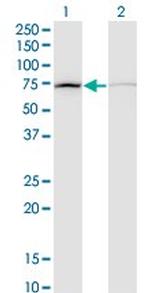 DAB2 Antibody in Western Blot (WB)