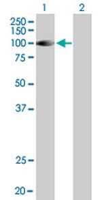 DGKG Antibody in Western Blot (WB)