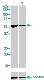 DARS Antibody in Western Blot (WB)