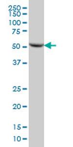 DARS Antibody in Western Blot (WB)