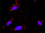 DAXX Antibody in Proximity Ligation Assay (PLA) (PLA)