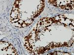 DAZ1 Antibody in Immunohistochemistry (Paraffin) (IHC (P))