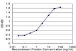 DBN1 Antibody in ELISA (ELISA)