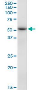 DBT Antibody in Western Blot (WB)