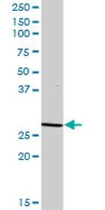 DCI Antibody in Western Blot (WB)