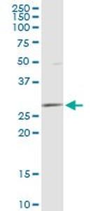 DCI Antibody in Western Blot (WB)