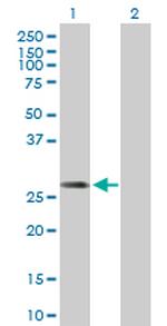 DCI Antibody in Western Blot (WB)