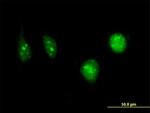 DCK Antibody in Immunocytochemistry (ICC/IF)