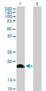 DCTD Antibody in Western Blot (WB)