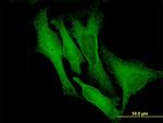 DCX Antibody in Immunocytochemistry (ICC/IF)