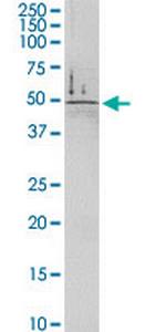 DDC Antibody in Western Blot (WB)