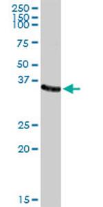 AKR1C2 Antibody in Western Blot (WB)