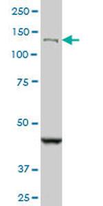 DHX8 Antibody in Western Blot (WB)