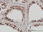 DHX9 Antibody in Immunohistochemistry (Paraffin) (IHC (P))