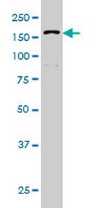 DHX9 Antibody in Western Blot (WB)