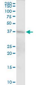 DFFA Antibody in Western Blot (WB)