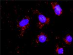 DFFA Antibody in Proximity Ligation Assay (PLA) (PLA)