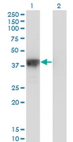 DFFA Antibody in Western Blot (WB)