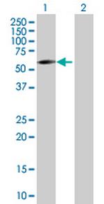 DHCR24 Antibody in Western Blot (WB)