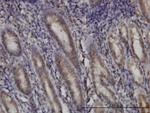 DHODH Antibody in Immunohistochemistry (Paraffin) (IHC (P))