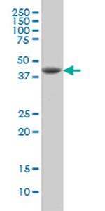 DHODH Antibody in Western Blot (WB)