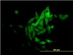 NQO1 Antibody in Immunocytochemistry (ICC/IF)