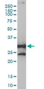 NQO1 Antibody in Western Blot (WB)