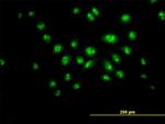 DKC1 Antibody in Immunocytochemistry (ICC/IF)