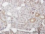 DKC1 Antibody in Immunohistochemistry (Paraffin) (IHC (P))