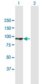 DLG3 Antibody in Western Blot (WB)