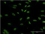 DLX1 Antibody in Immunocytochemistry (ICC/IF)