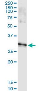 DLX1 Antibody in Immunoprecipitation (IP)