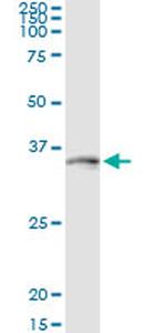 DLX1 Antibody in Immunoprecipitation (IP)