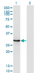 DLX1 Antibody in Western Blot (WB)