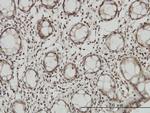 DLX2 Antibody in Immunohistochemistry (Paraffin) (IHC (P))