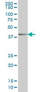 DLX2 Antibody in Western Blot (WB)