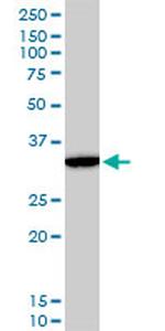 DLX5 Antibody in Western Blot (WB)