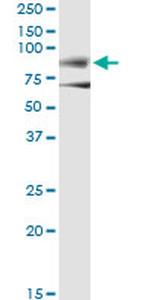 DMD Antibody in Immunoprecipitation (IP)