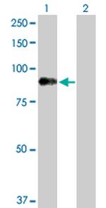 DMPK Antibody in Western Blot (WB)