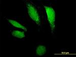 DNASE2 Antibody in Immunocytochemistry (ICC/IF)