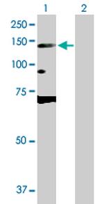 DNMT3A Antibody in Western Blot (WB)